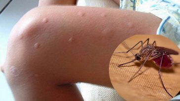 mosquitos