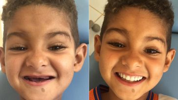 dentes_maior1