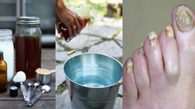 unhas