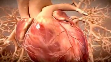 ataque_cardiaco