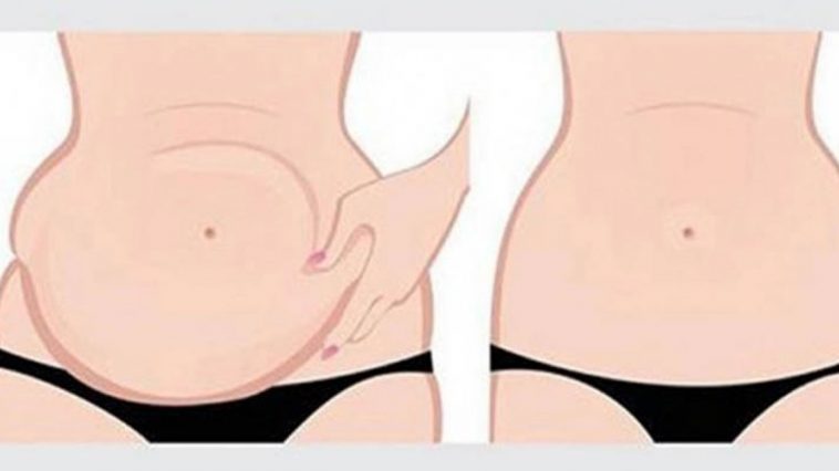 dieta