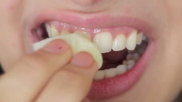 dentes_brancos-como-clarear