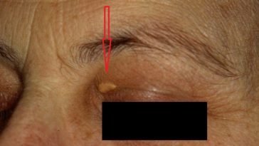 olhos-marca