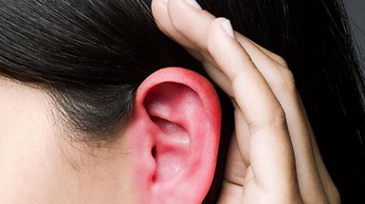 orelhas-vermelhas-quentes